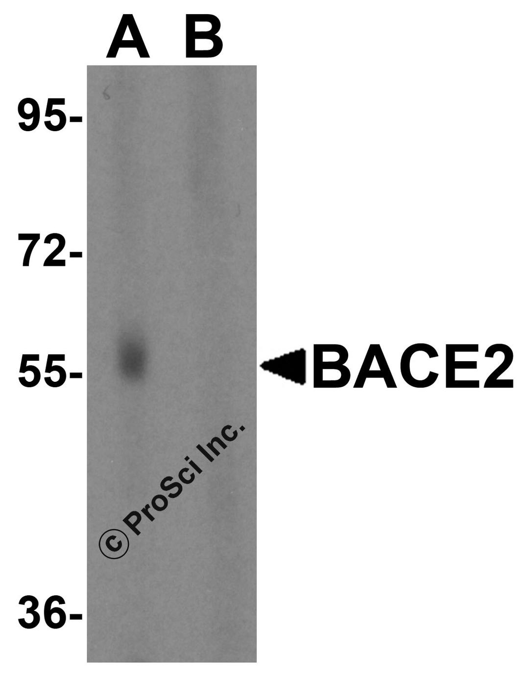 Western blot analysis of BACE2 in human heart tissue lysate in the absence (A) or presence (B) of blocking peptide with BACE2 antibody at 1 &#956;g/mL. 