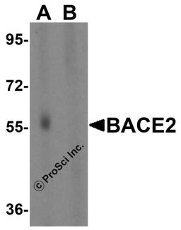 Western blot analysis of BACE2 in human heart tissue lysate in the absence (A) or presence (B) of blocking peptide with BACE2 antibody at 1 μg/mL.