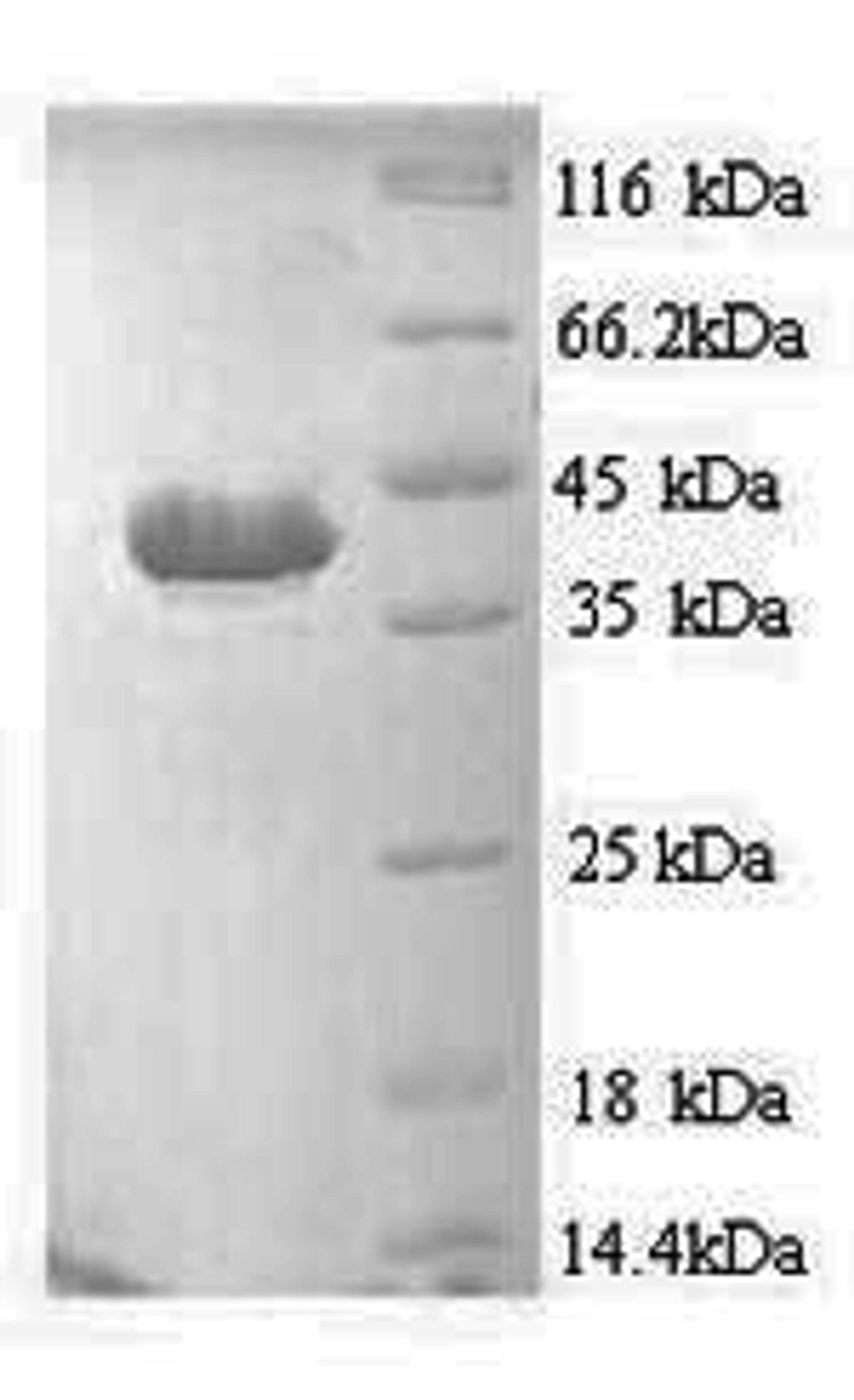 (Tris-Glycine gel) Discontinuous SDS-PAGE (reduced) with 5% enrichment gel and 15% separation gel.