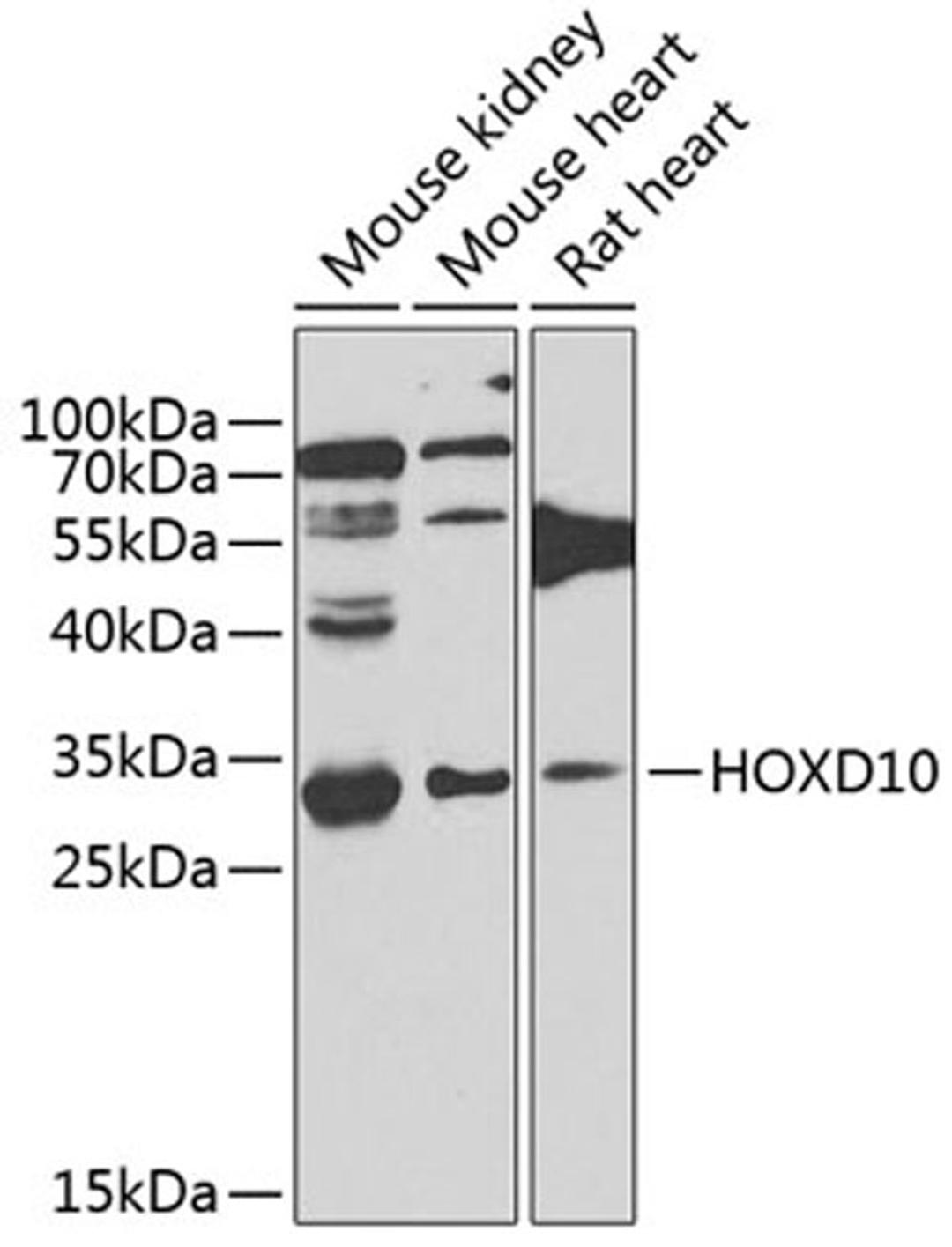 Western blot - HOXD10 antibody (A7686)