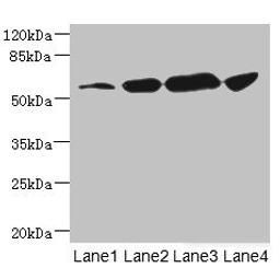 Western blot. All lanes: CHRNA6 antibody at 3.72ug/ml. Lane 1: A431 whole cell lysate. Lane 2: A549 whole cell lysate. Lane 3: Hela whole cell lysate. Lane 4: HepG2 whole cell lysate. Secondary. Goat polyclonal to rabbit IgG at 1/10000 dilution. Predicted band size: 57, 56 kDa. Observed band size: 57 kDa. 