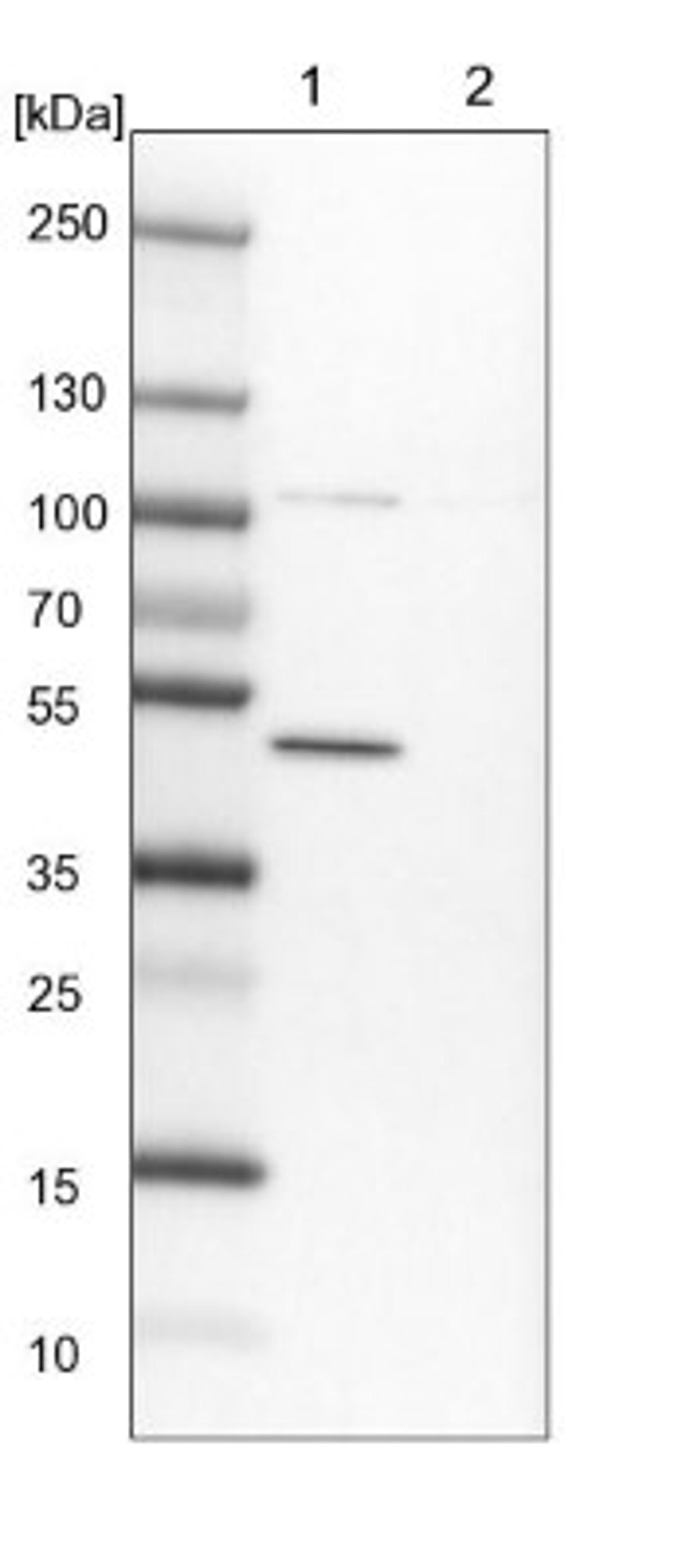 Western Blot: BTBD3 Antibody [NBP1-84214] - Lane 1: NIH-3T3 cell lysate (Mouse embryonic fibroblast cells)<br/>Lane 2: NBT-II cell lysate (Rat Wistar bladder tumour cells)