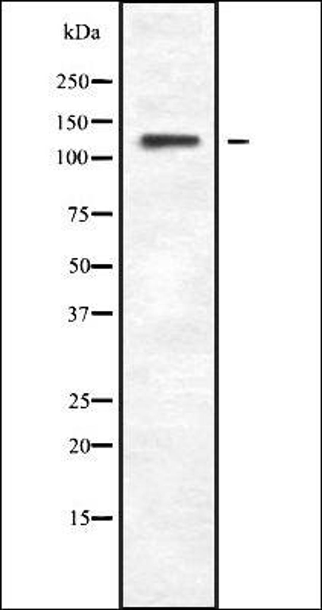 Western blot analysis of HEK293 cells using PLCB4 antibody