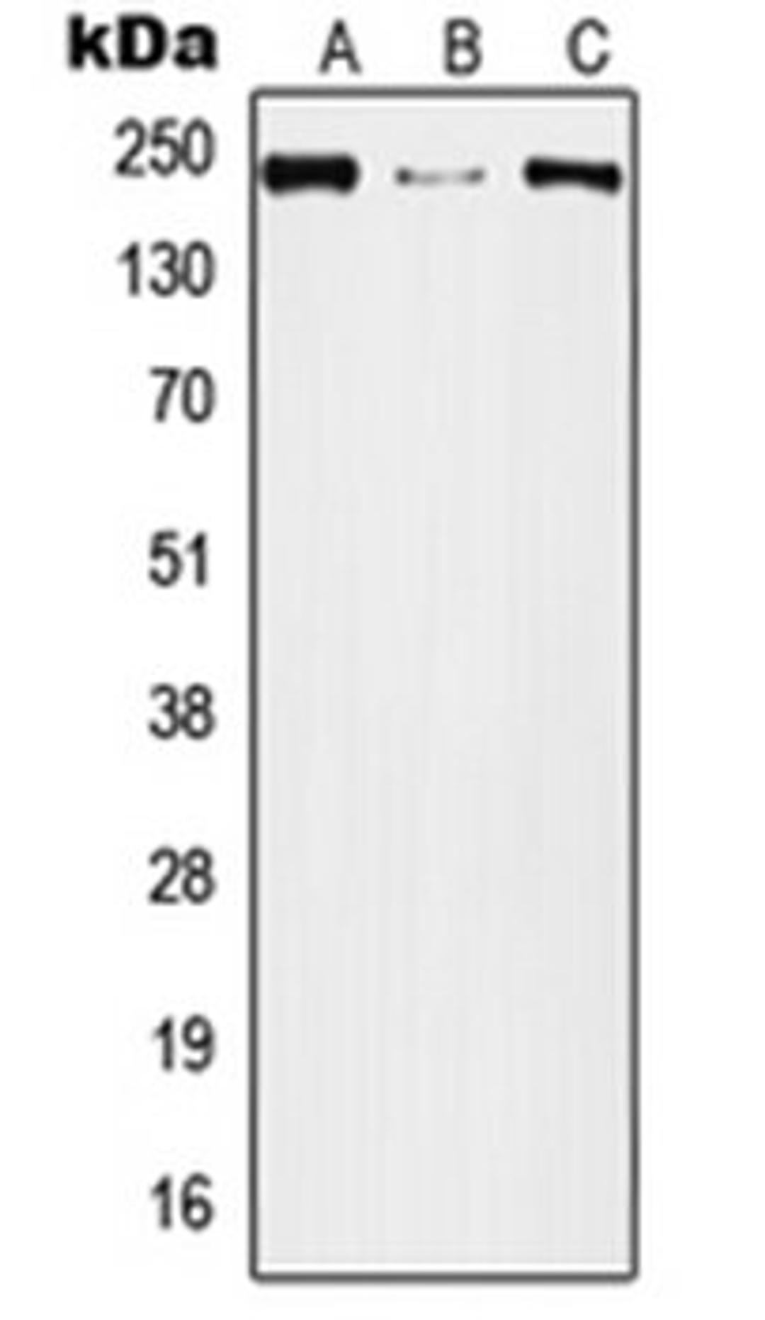 Western blot analysis of A549 (Lane 1), Raw264.7 (Lane 2), PC12 (Lane 3) whole cell lysates using PLXNA2 antibody