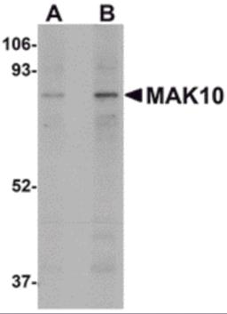 Western blot analysis of MAK10 in mouse heart tissue lysate with MAK10 antibody at (A) 1 and (B) 2 &#956;g/mL.