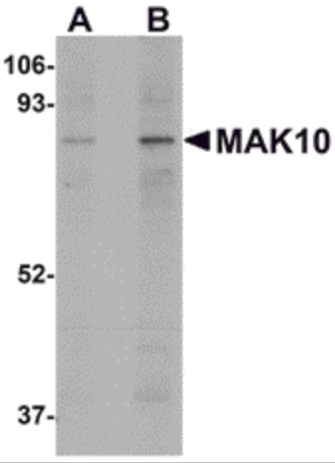 Western blot analysis of MAK10 in mouse heart tissue lysate with MAK10 antibody at (A) 1 and (B) 2 μg/mL.