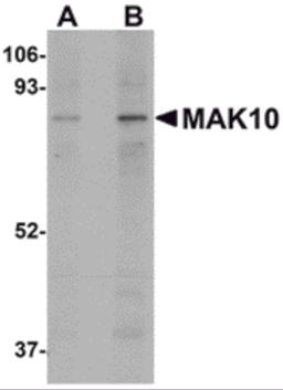 Western blot analysis of MAK10 in mouse heart tissue lysate with MAK10 antibody at (A) 1 and (B) 2 μg/mL.