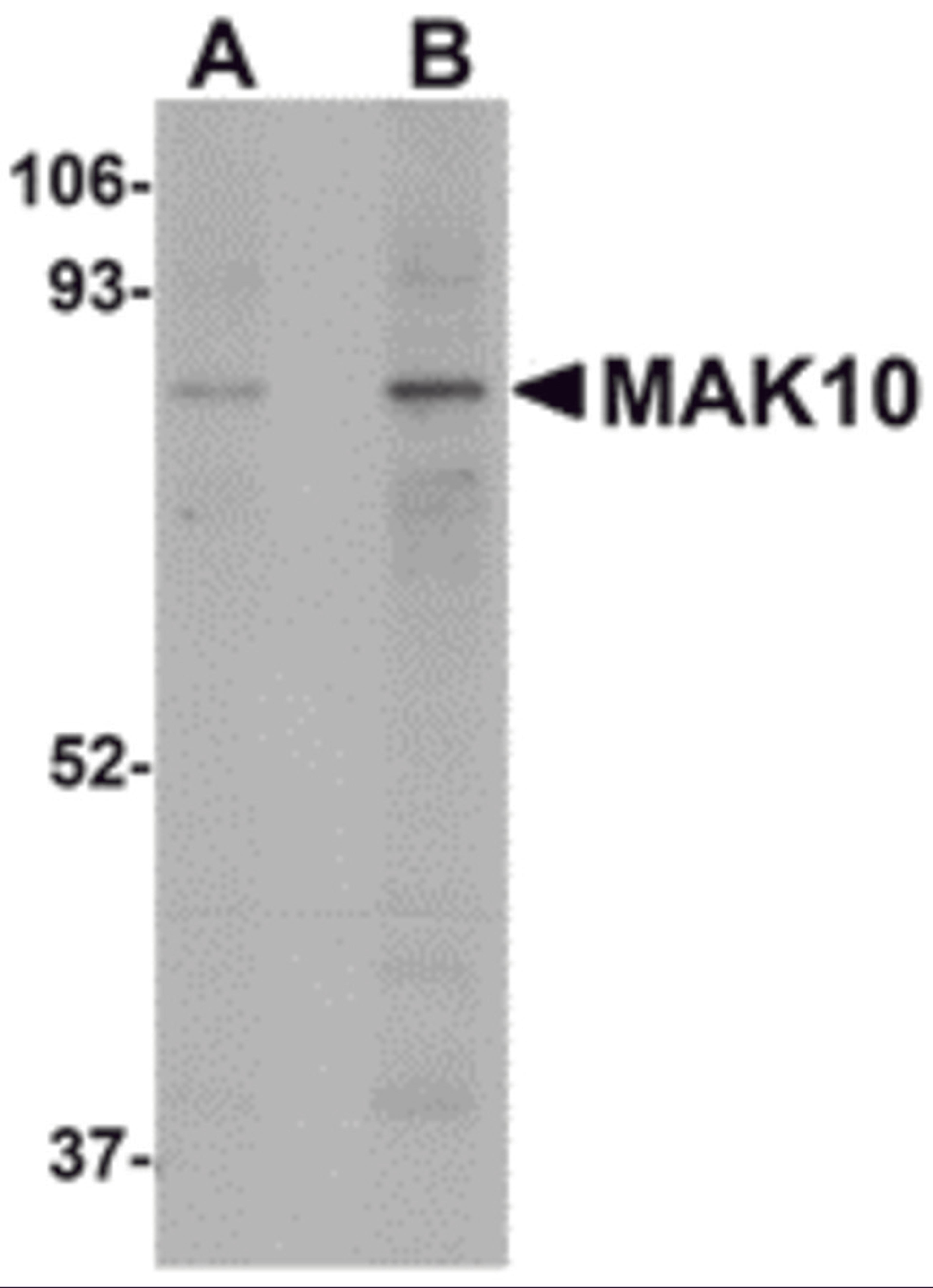 Western blot analysis of MAK10 in mouse heart tissue lysate with MAK10 antibody at (A) 1 and (B) 2 μg/mL.