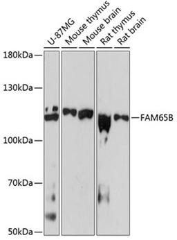 Western blot - FAM65B antibody (A9234)