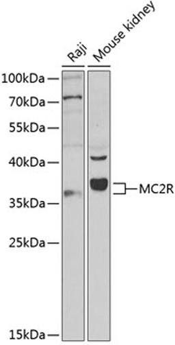 Western blot - MC2R antibody (A3010)