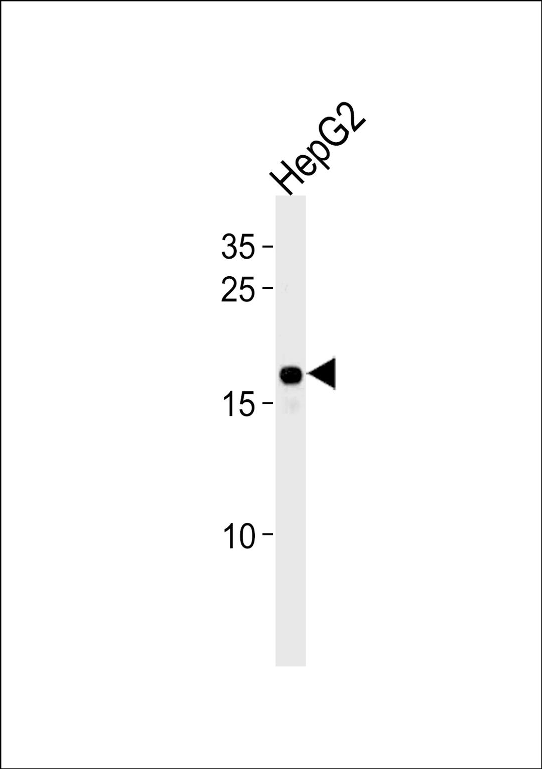 Western blot analysis in HepG2 cell line lysates (35ug/lane).