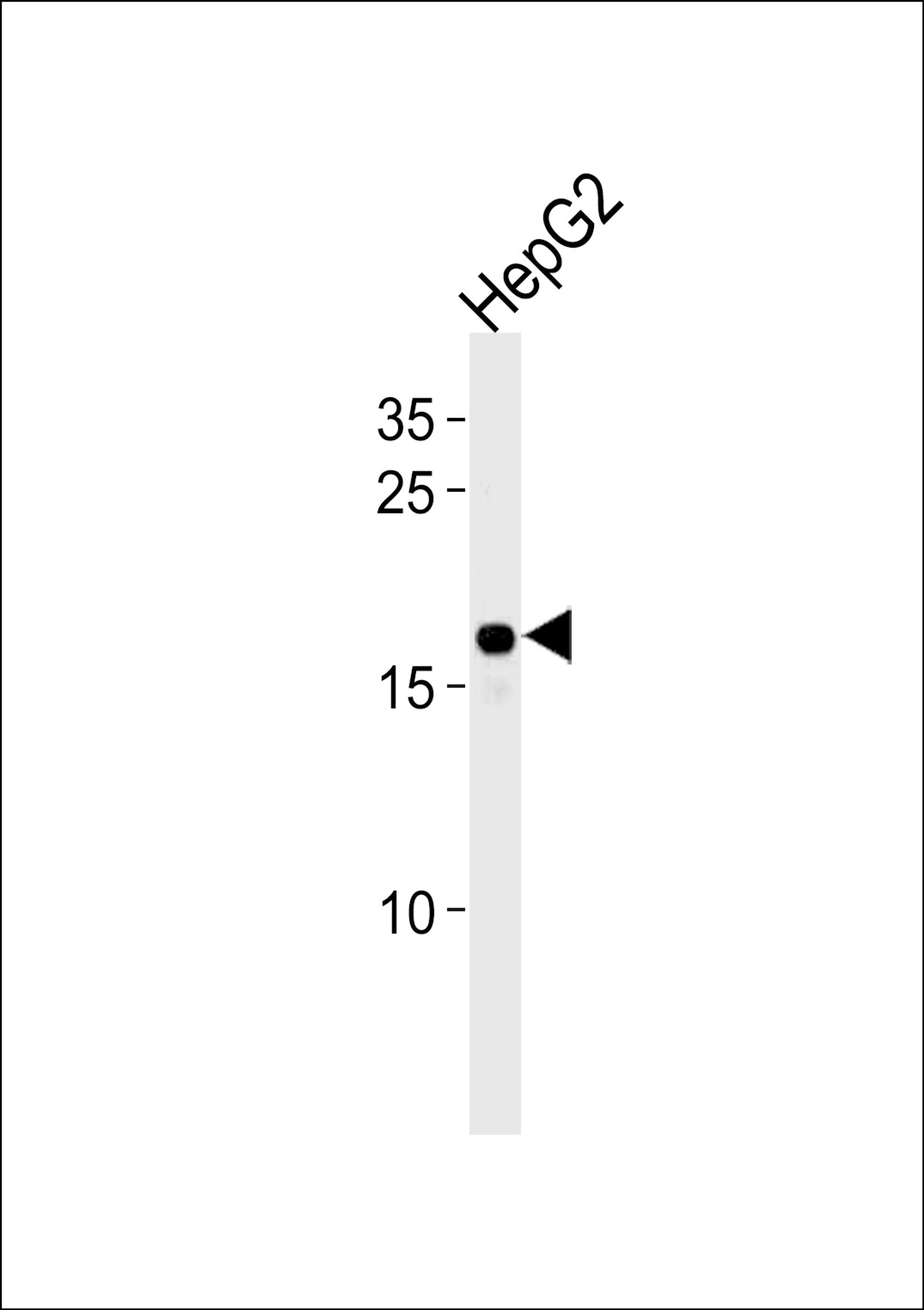 Western blot analysis in HepG2 cell line lysates (35ug/lane).