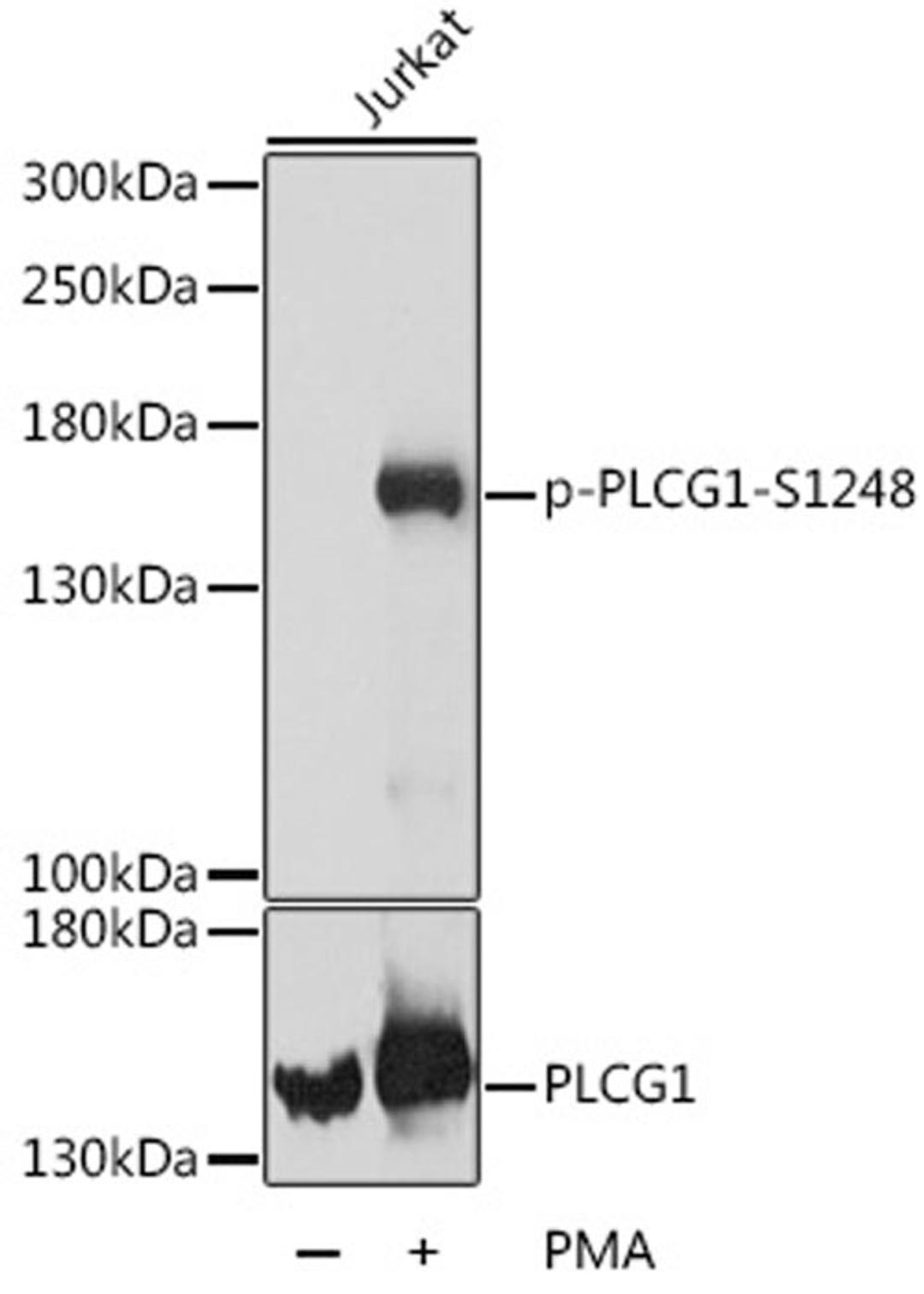 Western blot - Phospho-PLCG1-S1248 antibody (AP0827)