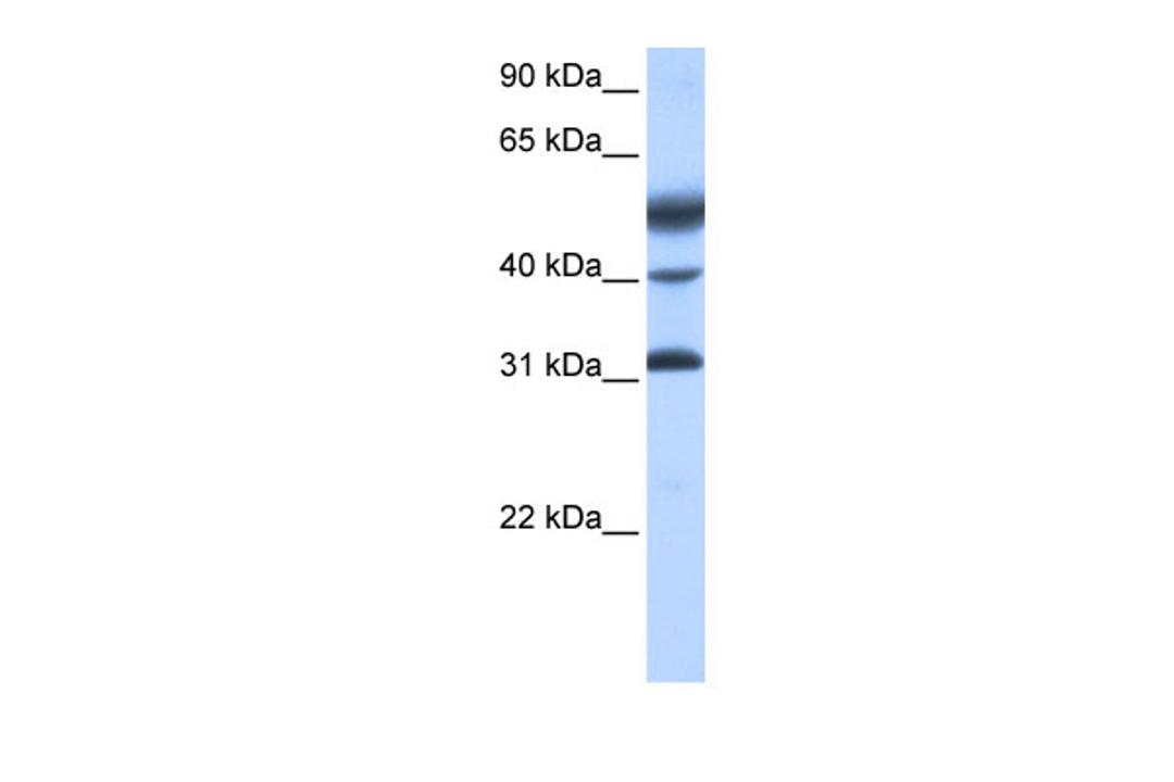 Antibody used in WB on Human Placenta at 0.2-1 ug/ml.