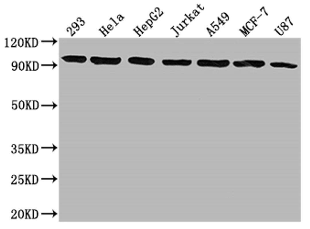 Western Blot. Positive WB detected in: 293 whole cell lysate, Hela whole cell lysate, HepG2 whole cell lysate, Jurkat whole cell lysate, A549 whole cell lysate, MCF-7 whole cell lysate, U87 whole cell lysate. All lanes: NR3C1 antibody at 1:1500. Secondary. Goat polyclonal to rabbit IgG at 1/50000 dilution. Predicted band size: 86, 83, 82, 77, 76, 65, 61, 52, 51, 50 kDa. Observed band size: 95 kDa. 