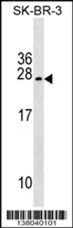 Western blot analysis in SK-BR-3 cell line lysates (35ug/lane).