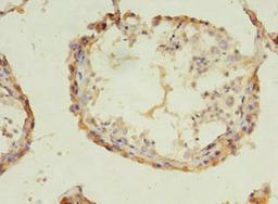 Immunohistochemistry of paraffin-embedded human testis tissue using CSB-PA897539LA01HU at dilution of 1:100