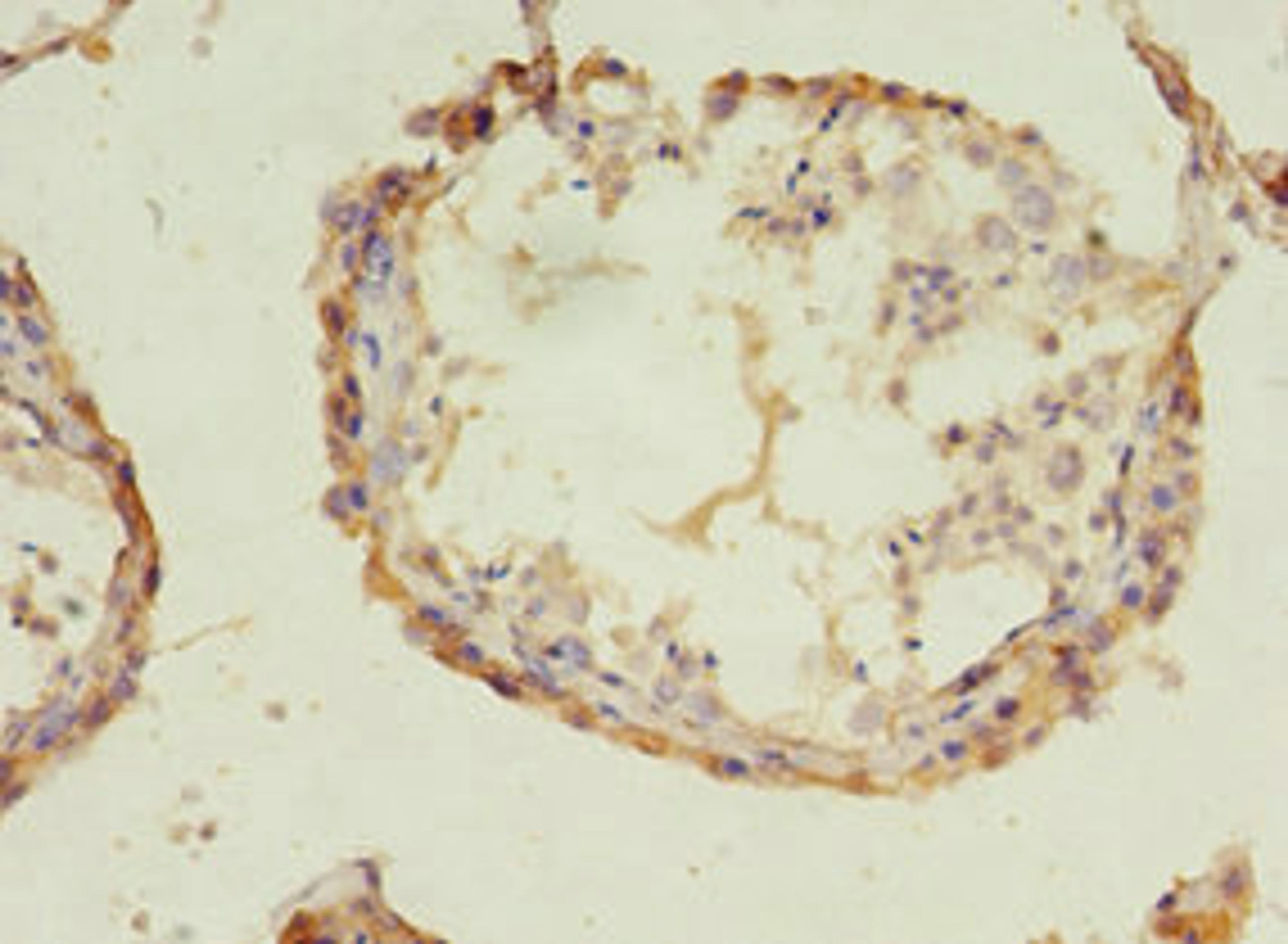Immunohistochemistry of paraffin-embedded human testis tissue using CSB-PA897539LA01HU at dilution of 1:100