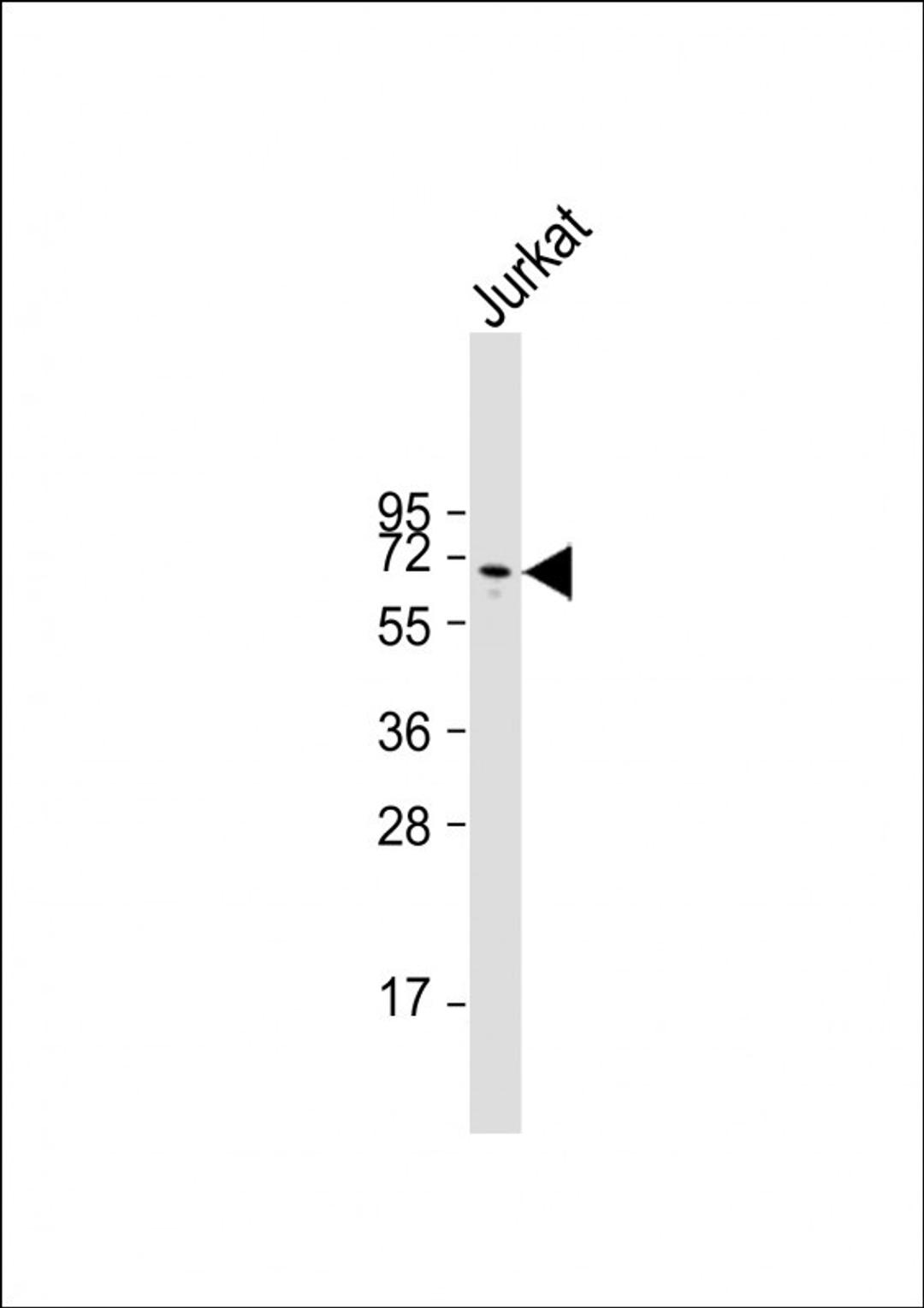 Western Blot at 1:2000 dilution + Jurkat whole cell lysate Lysates/proteins at 20 ug per lane.