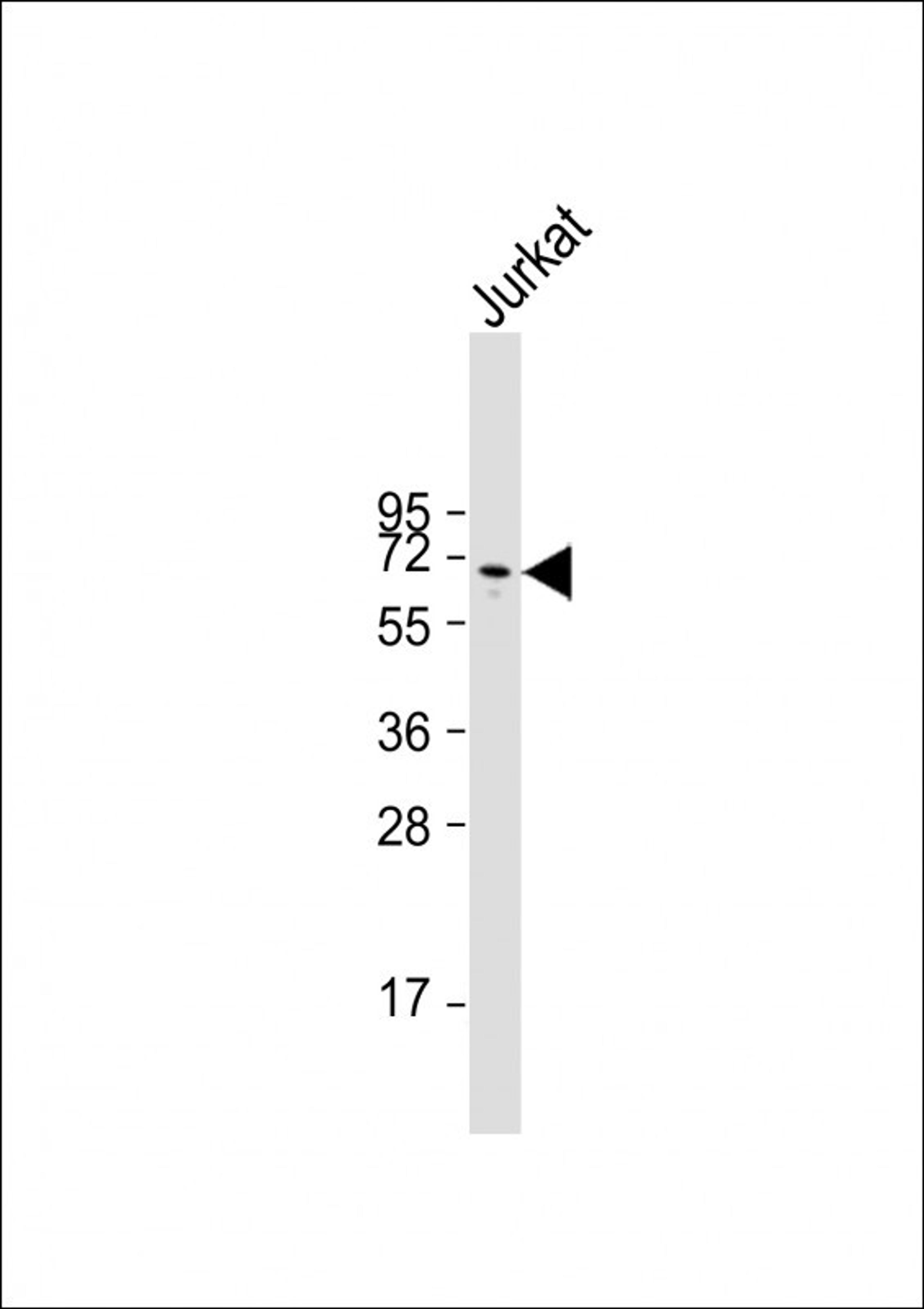 Western Blot at 1:2000 dilution + Jurkat whole cell lysate Lysates/proteins at 20 ug per lane.