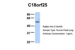 Western Blot: C18orf25 Antibody [NBP1-57595] - Human Fetal Lung, Antibody Dilution: 1.0 ug/ml.