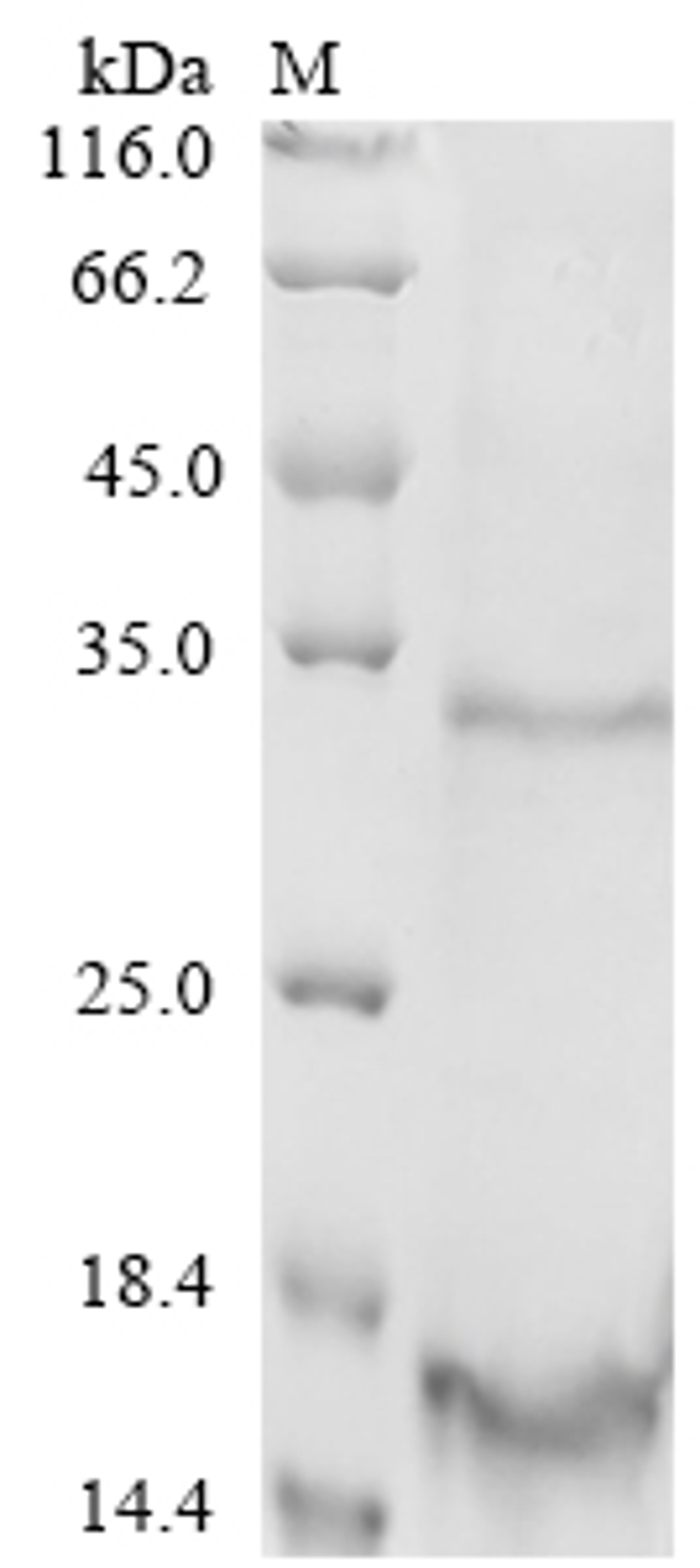 (Tris-Glycine gel) Discontinuous SDS-PAGE (reduced) with 5% enrichment gel and 15% separation gel.