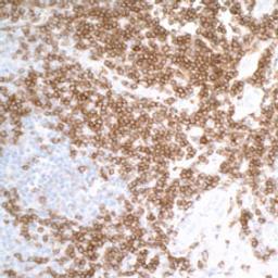 Detection of human CD27 in FFPE tonsil by IHC.