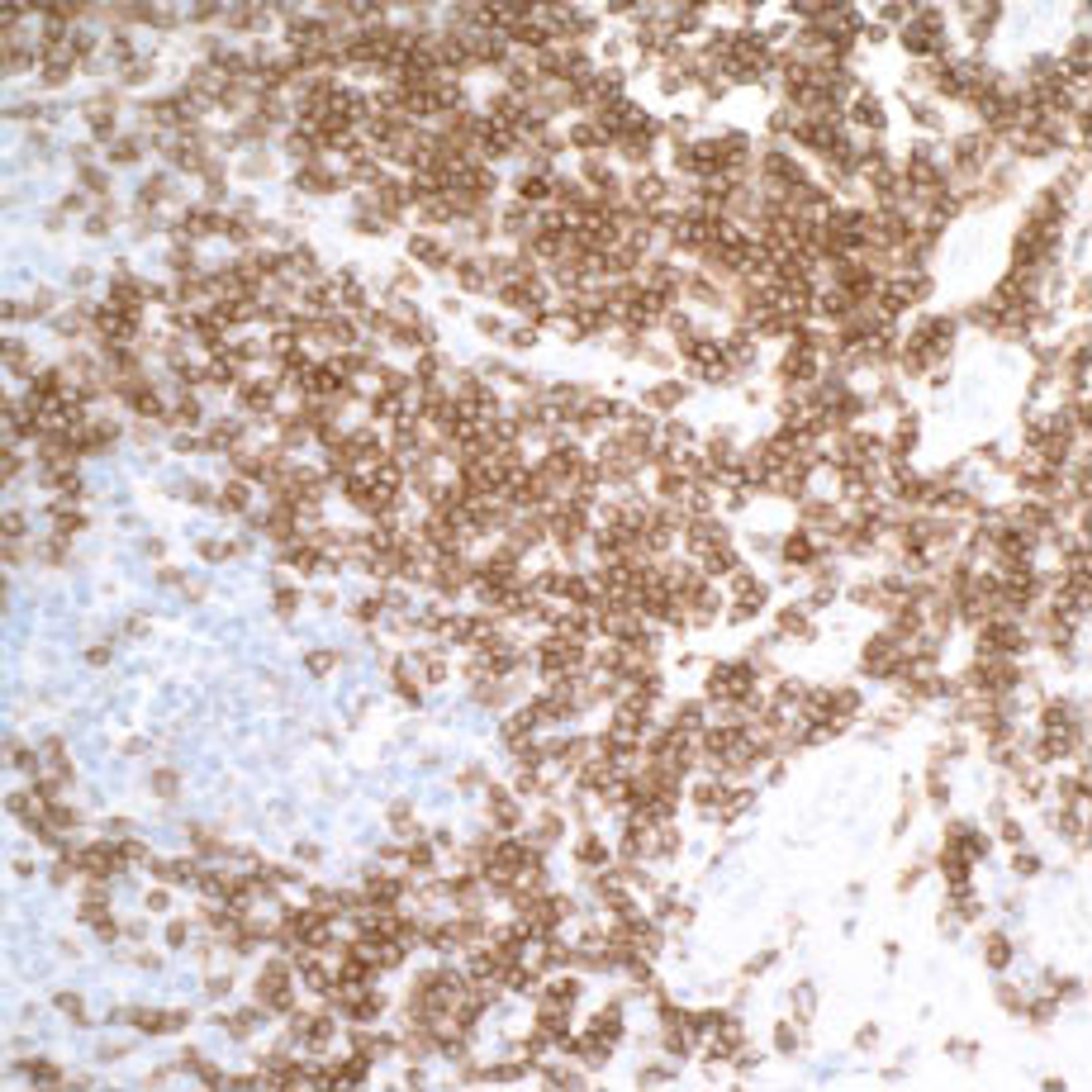 Detection of human CD27 in FFPE tonsil by IHC.