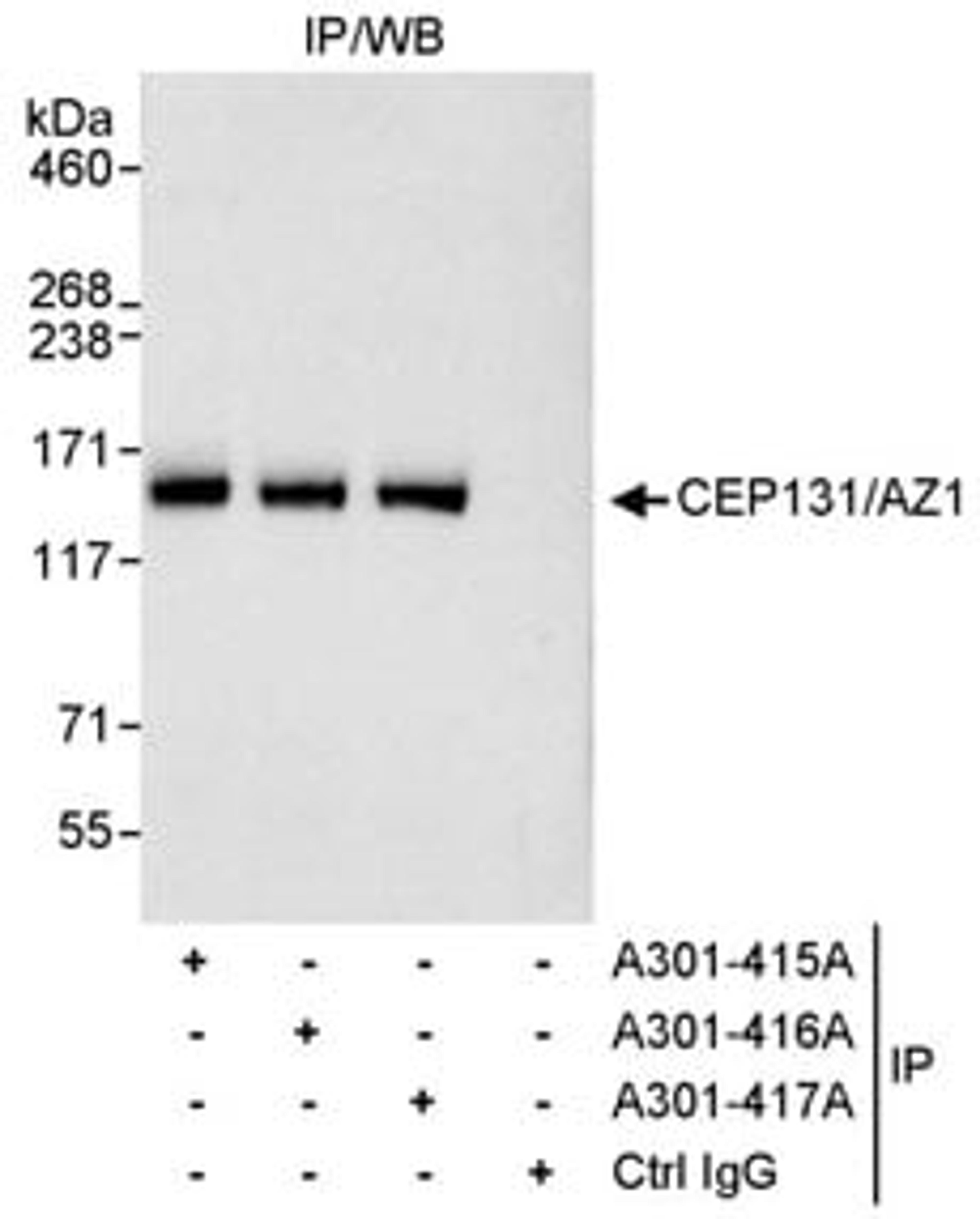 Detection of human CEP131/AZ1 by western blot of immunoprecipitates.