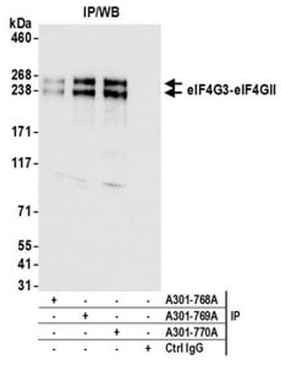 Detection of human eIF4G3/eIF4GII by western blot of immunoprecipitates.