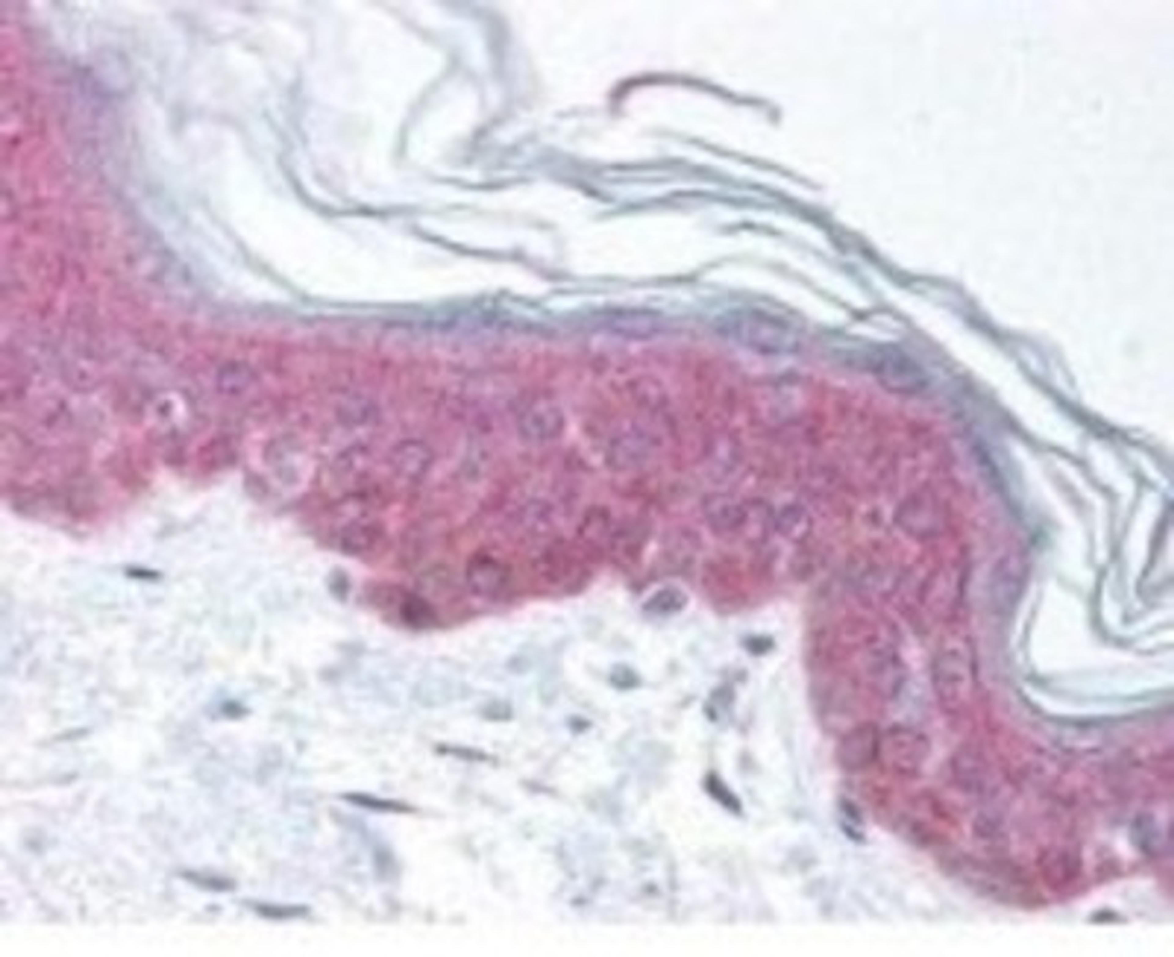 Immunohistochemistry-Paraffin: ASAP1 [p Tyr782] Antibody [NBP1-77933] - This antibody was used at 20 ug/ml in a variety of tissues including multi-human, multi-brain and multi-cancer slides. This image shows moderate intracellular positive staining in epidermal keratinocytes in human skin at 40X. The image shows localization of the antibody as the precipitated red signal, with a hematoxylin purple nuclear counterstain.