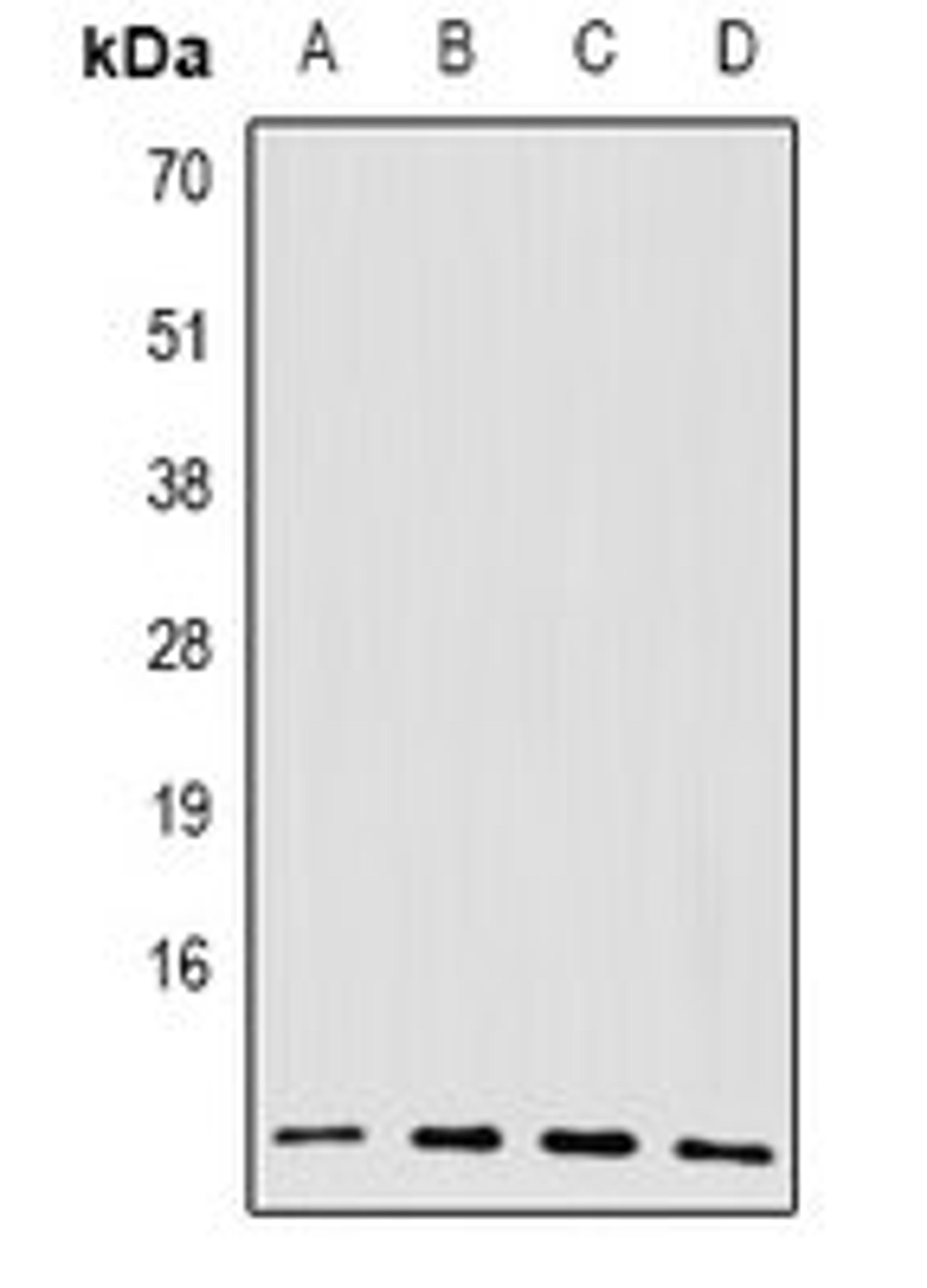 Western blot analysis of A549 (Lane1), SKOV3 (Lane2), mouse spleen (Lane3), rat spleen (Lane4) whole cell lysates using BLID antibody