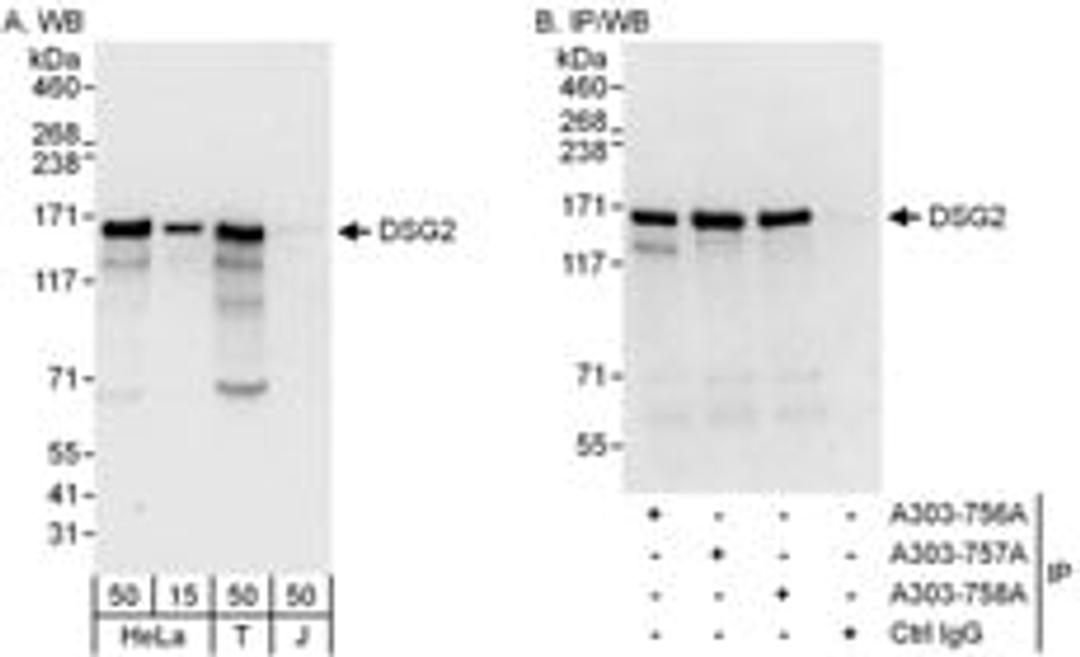 Detection of human DSG2 by western blot and immunoprecipitation.