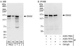 Detection of human DSG2 by western blot and immunoprecipitation.