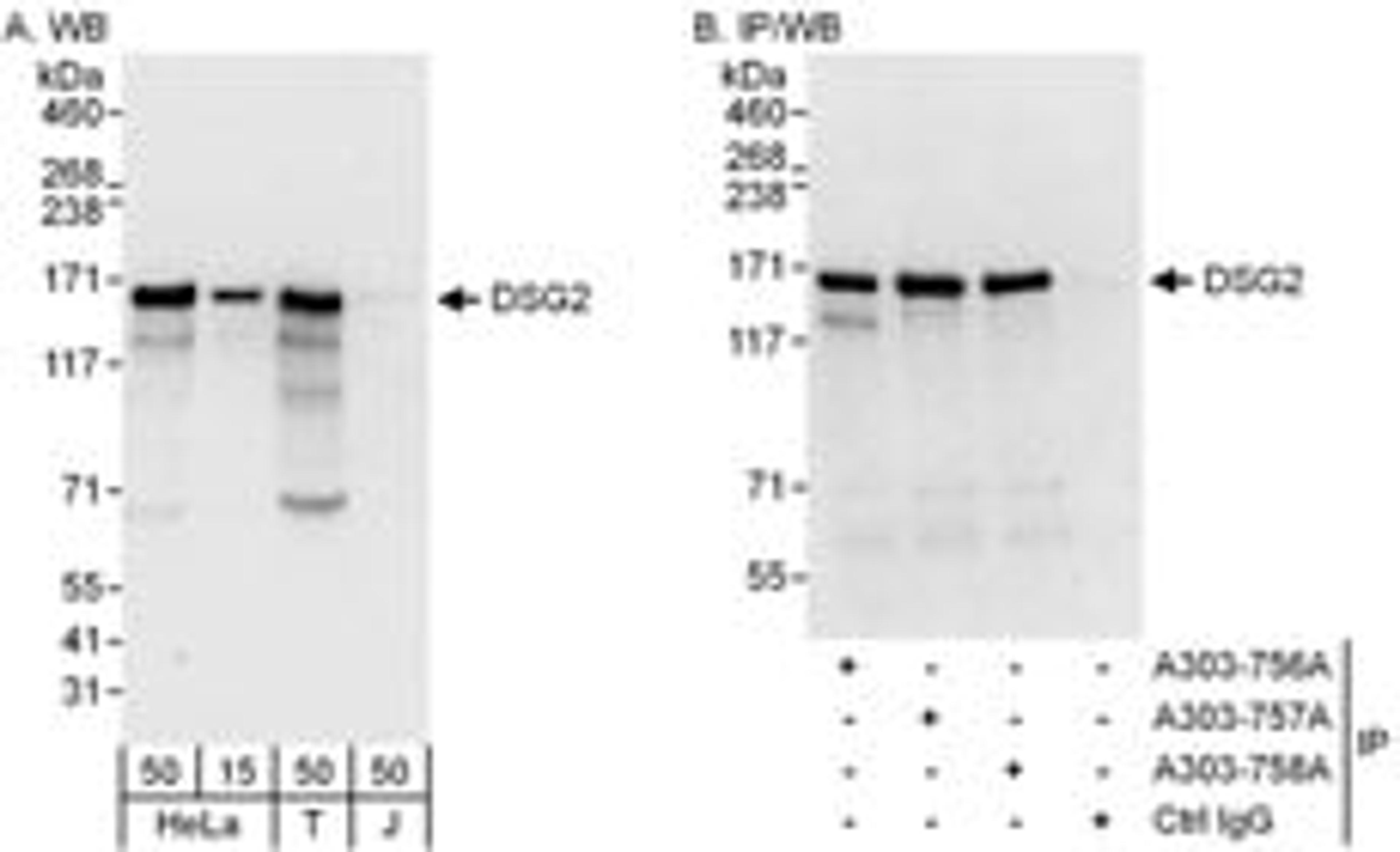 Detection of human DSG2 by western blot and immunoprecipitation.