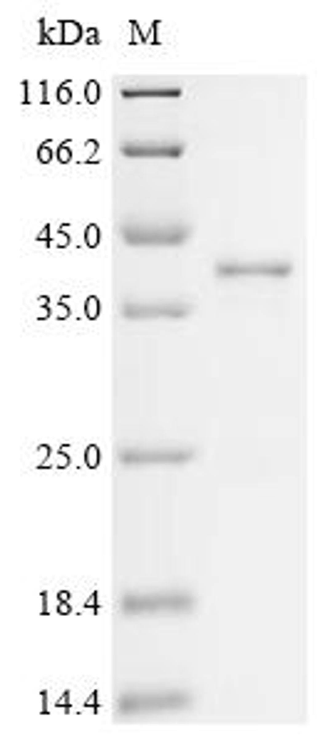 (Tris-Glycine gel) Discontinuous SDS-PAGE (reduced) with 5% enrichment gel and 15% separation gel.
