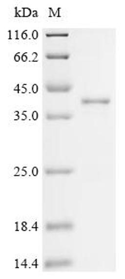 (Tris-Glycine gel) Discontinuous SDS-PAGE (reduced) with 5% enrichment gel and 15% separation gel.