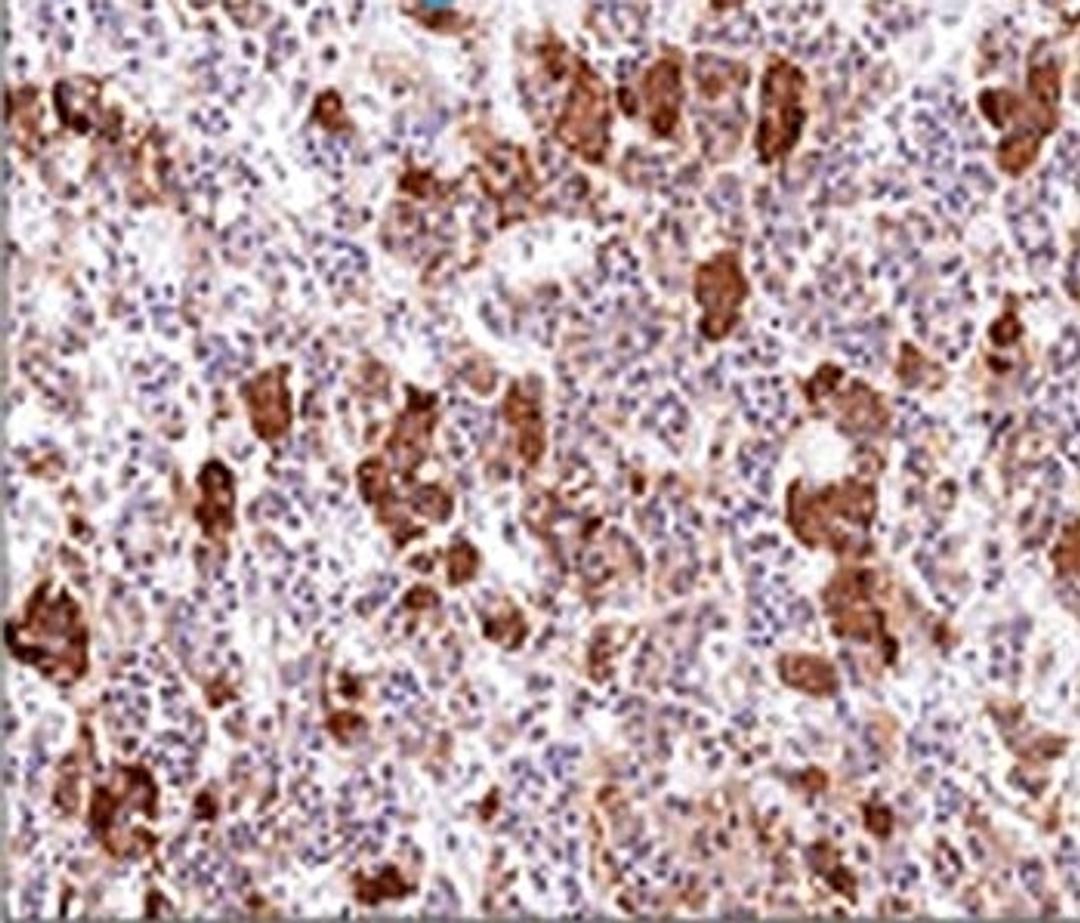 IHC testing of human pituitary gland stained with ACTH antibody (AH26).