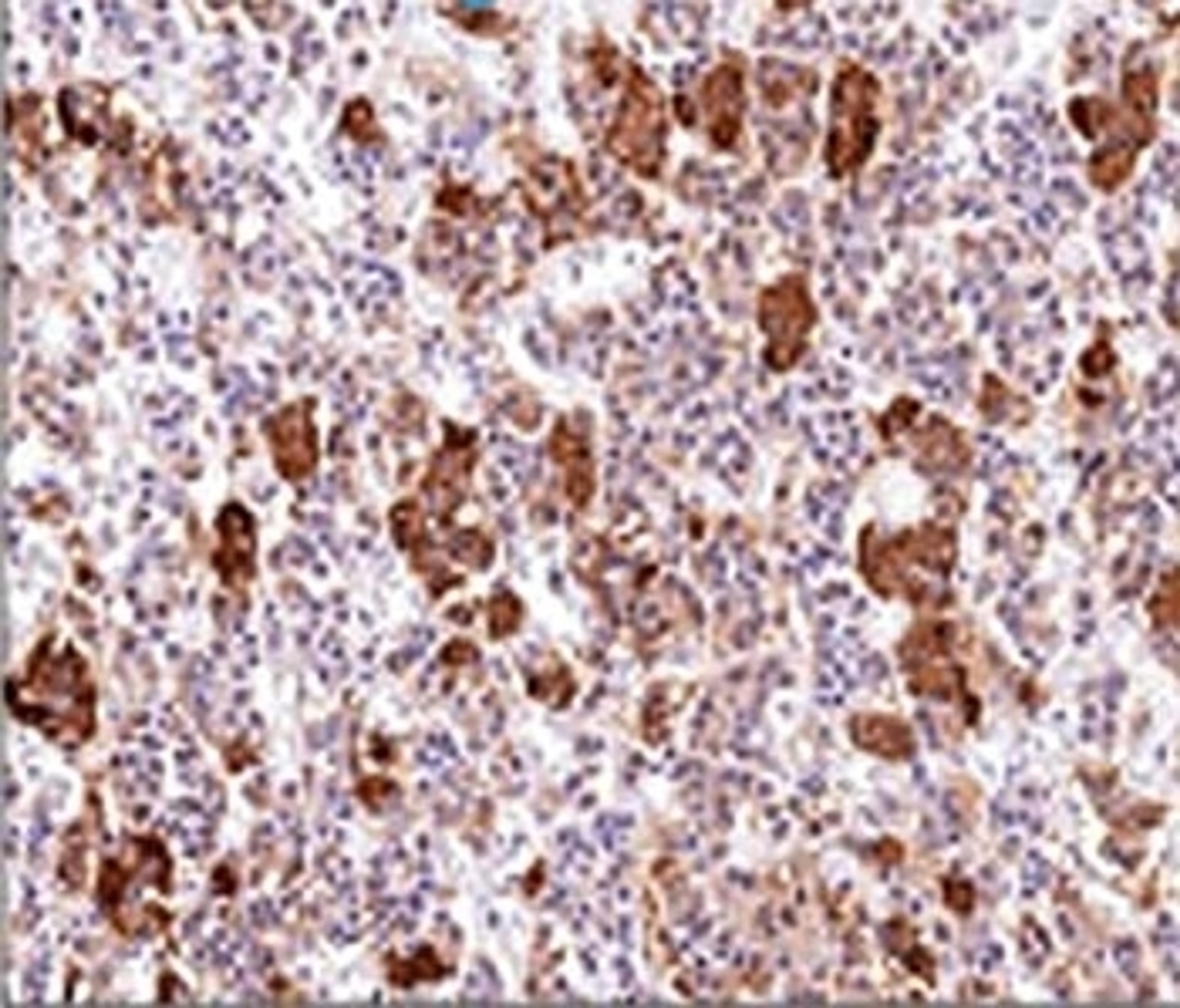 IHC testing of human pituitary gland stained with ACTH antibody (AH26).