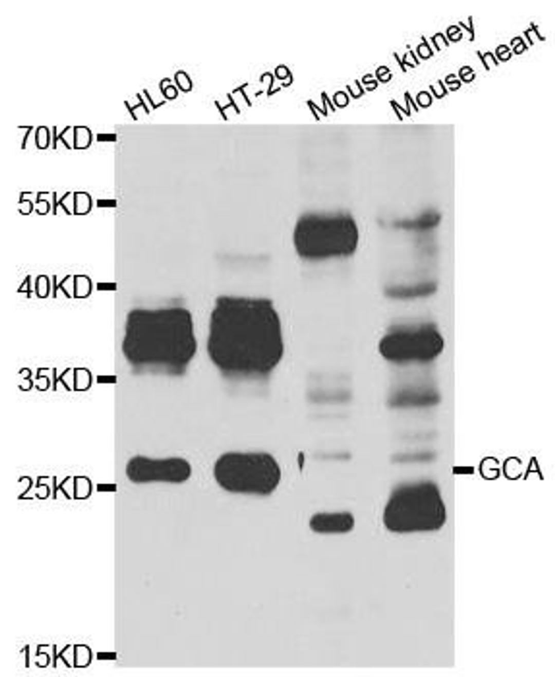 Western blot analysis of extracts of various cell lines using GCA antibody