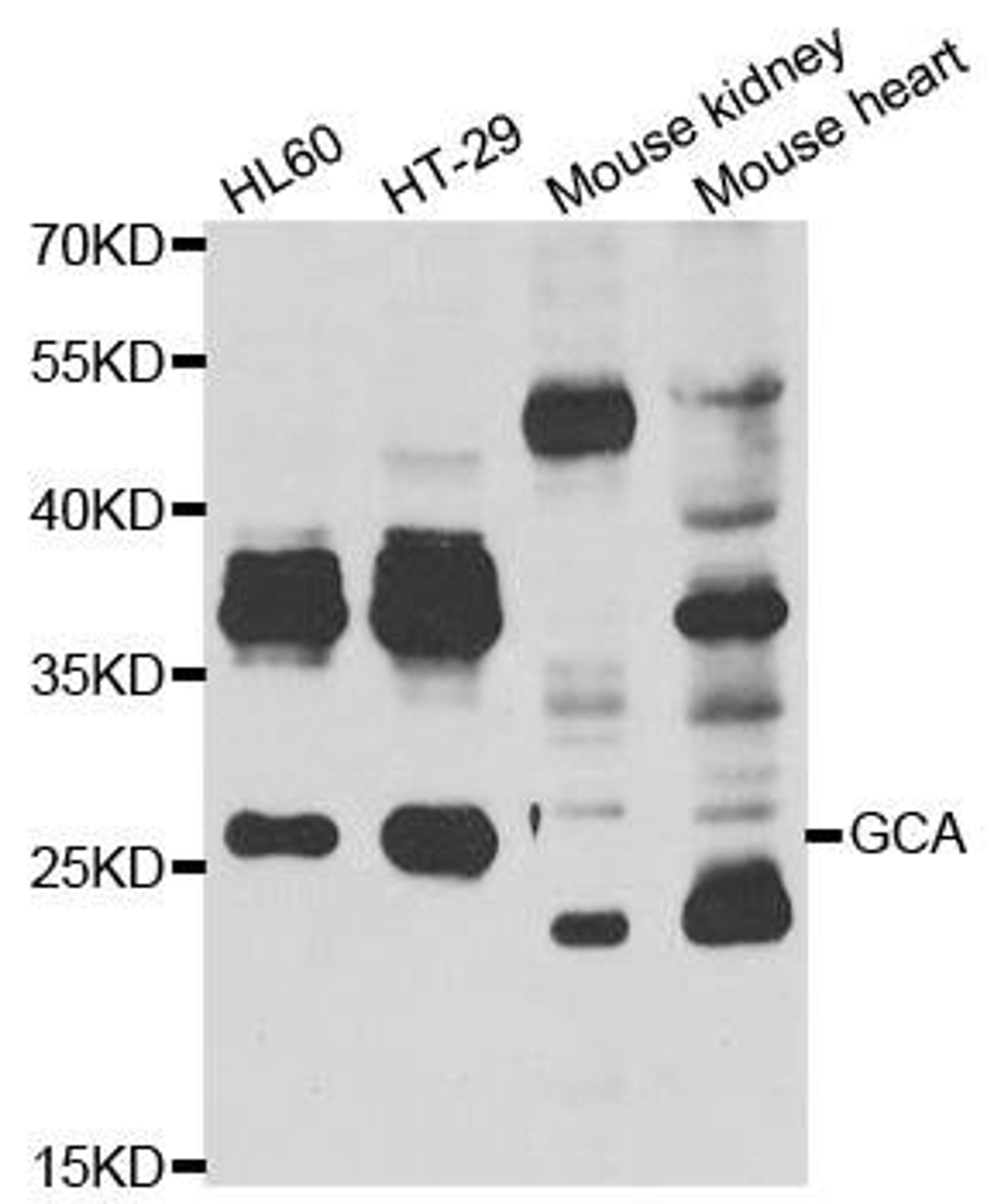 Western blot analysis of extracts of various cell lines using GCA antibody