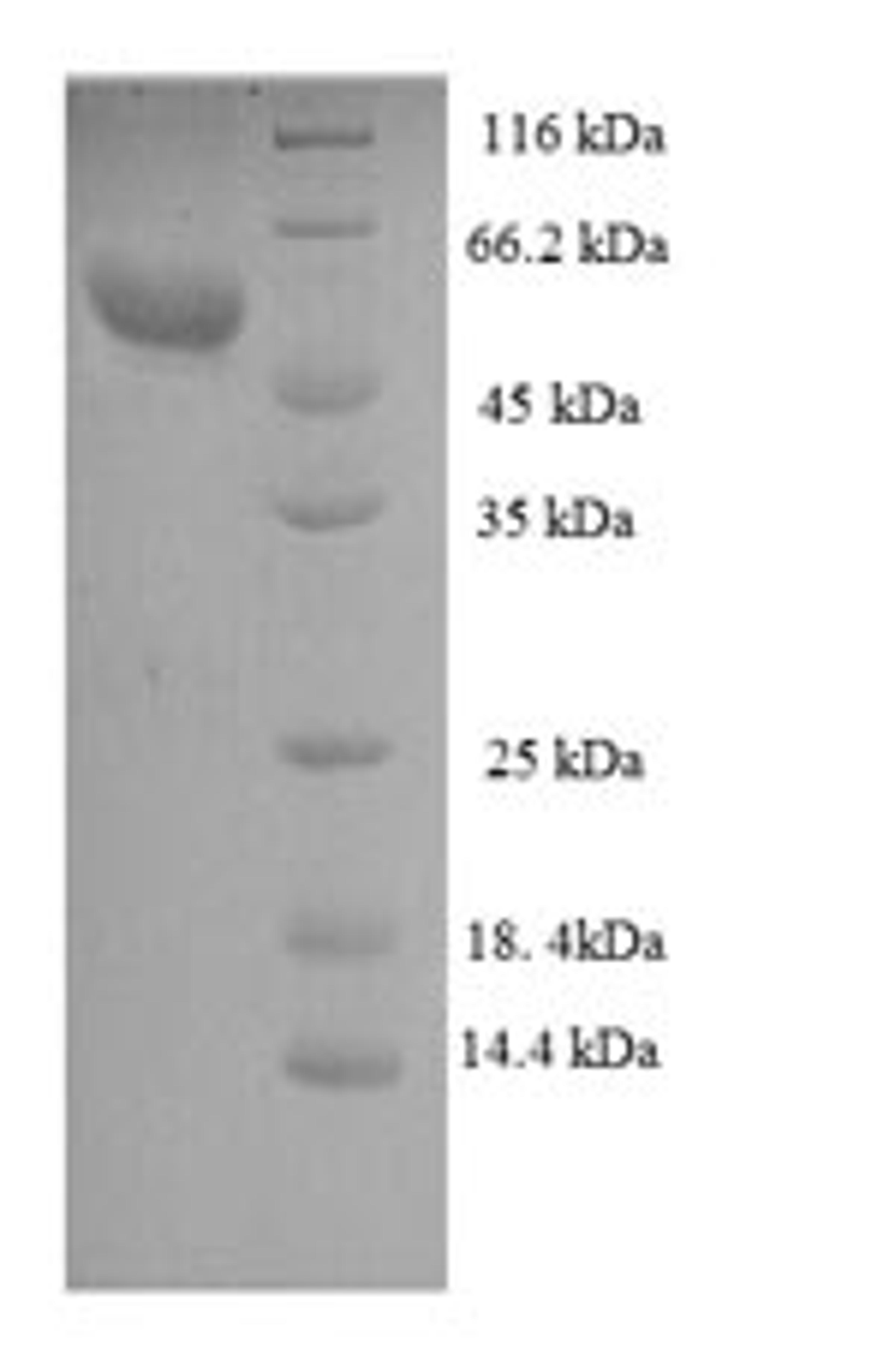 (Tris-Glycine gel) Discontinuous SDS-PAGE (reduced) with 5% enrichment gel and 15% separation gel.