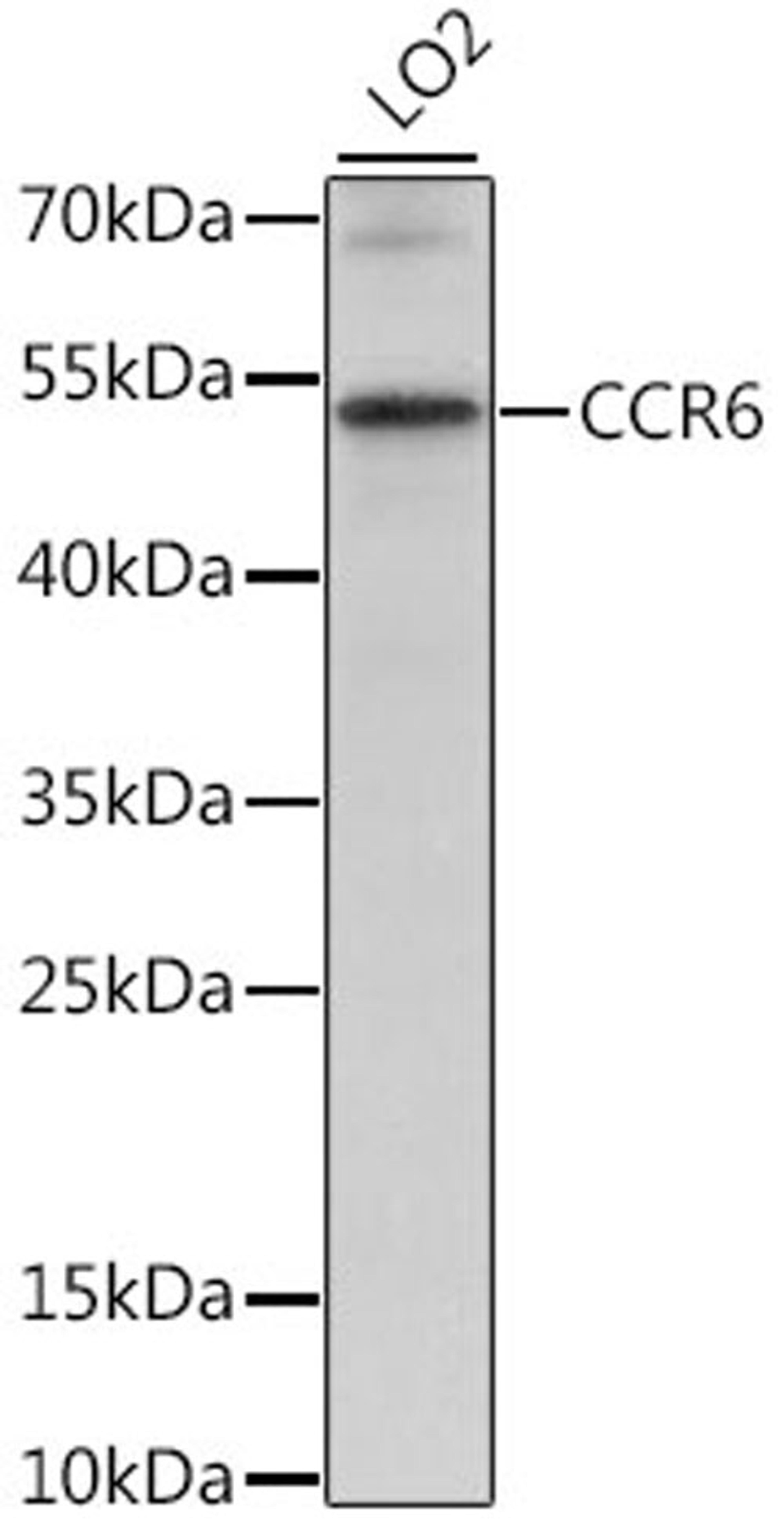 Western blot - CCR6 antibody (A16206)