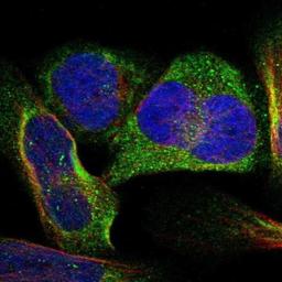 Immunocytochemistry: C7orf53 Antibody [NBP1-81923] - Immunofluorescence:  [NBP1-81923] - Staining of human cell line U-2 OS shows positivity in cytoplasm.