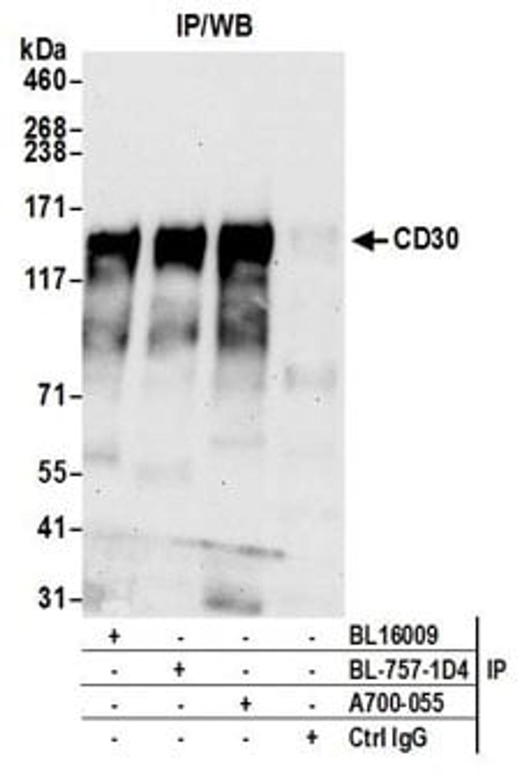 Detection of human CD30 by western blot of immunoprecipitates.