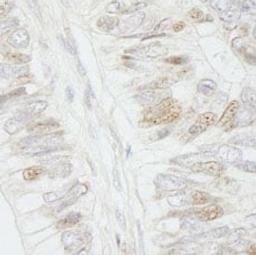 Detection of human APC by immunohistochemistry.