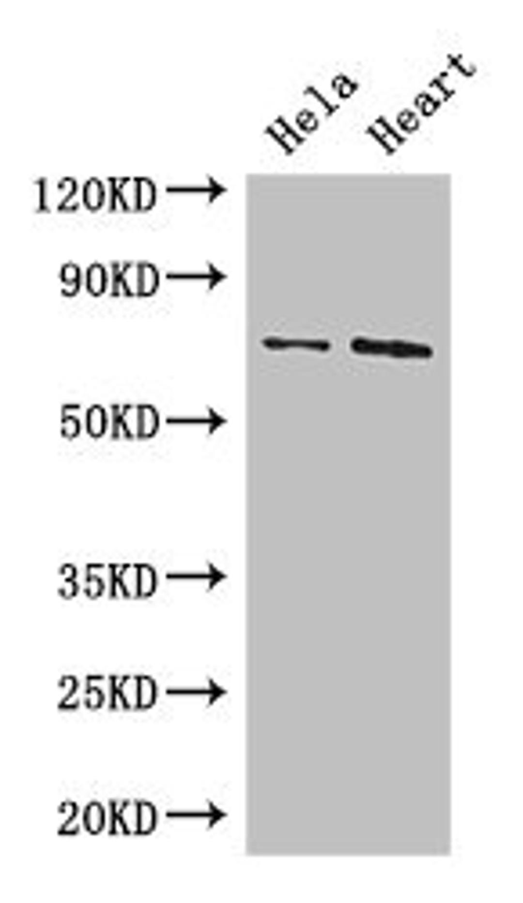 Western Blot. Positive WB detected in: Hela whole cell lysate, Mouse heart tissue. All lanes: PCK2 antibody at 3.4µg/ml. Secondary. Goat polyclonal to rabbit IgG at 1/50000 dilution. Predicted band size: 71, 48, 56 kDa. Observed band size: 71 kDa