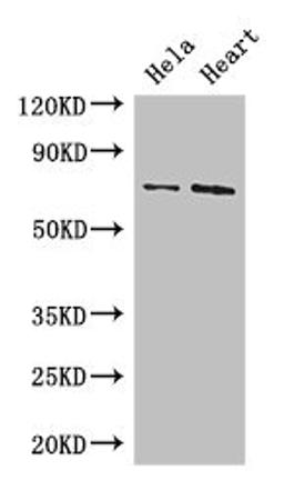 Western Blot. Positive WB detected in: Hela whole cell lysate, Mouse heart tissue. All lanes: PCK2 antibody at 3.4µg/ml. Secondary. Goat polyclonal to rabbit IgG at 1/50000 dilution. Predicted band size: 71, 48, 56 kDa. Observed band size: 71 kDa