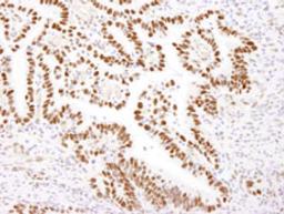 Detection of human Nucleolin by immunohistochemistry.