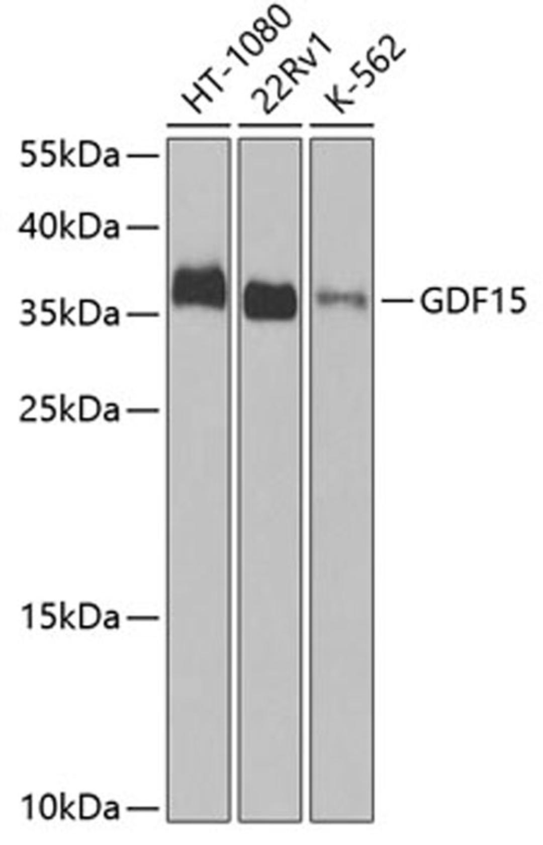 Western blot - GDF15 Antibody (A0185)